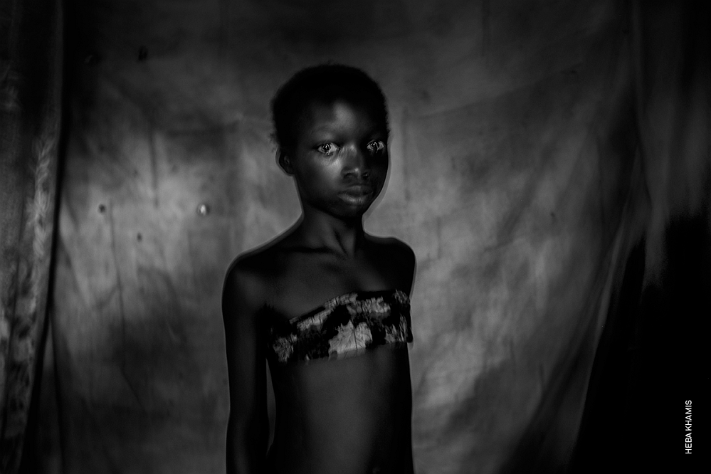 Heba-Khamis-Die-brutale-Praktik-des-Brustbügelns-in-Kamerun-wird-zum-Schutz-des-Kindes-durchgeführ-Heba-Khamis-Online