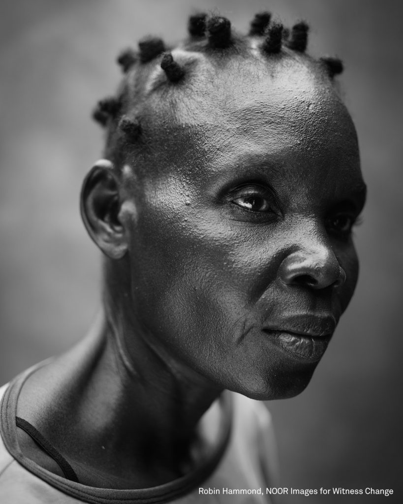 Hellen (41) lives with a mental health problem. Her illness developed later in life. In developing countries, over 80 percent of people living with mental health problems do not receive any treatment. In African countries, treatment often comes in the form of prayer from a pastor or traditional healer. Modern medicine is available to very few. A mental health problem often means relegation to the margins of society; life in mental health facilities often doing more harm than good, and coming attached with crippling social stigma. Cultural beliefs and associations that link mental disorders to witchcraft are deeply rooted in some communities.
