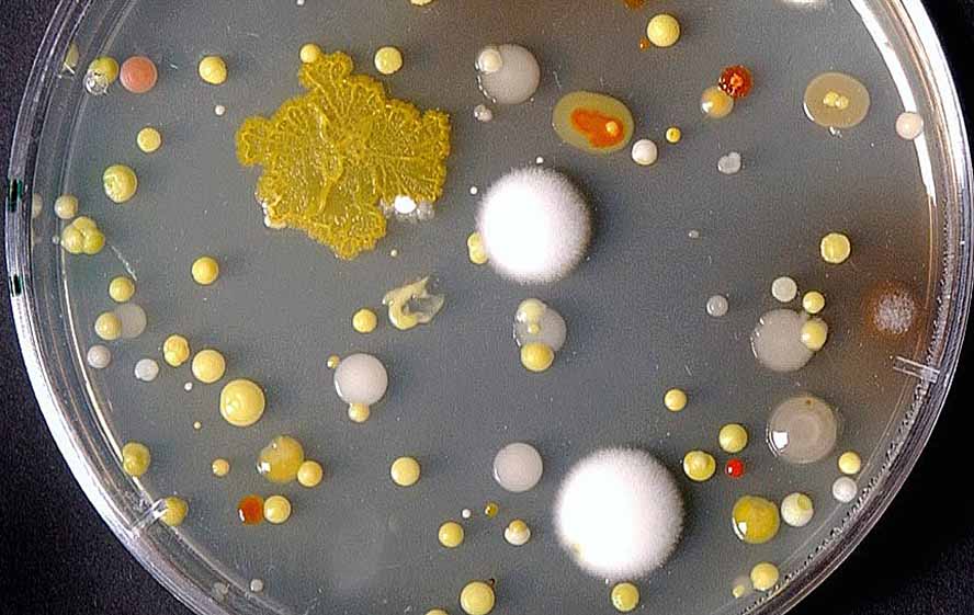 In einer Petrischale züchten Wissenschaftler*innen der Fakultät Bio- und Chemieingenieurwesen Bakterien für Forschungszwecke. Bild: Dr. Armin Quentmeier/ TU Dortmund